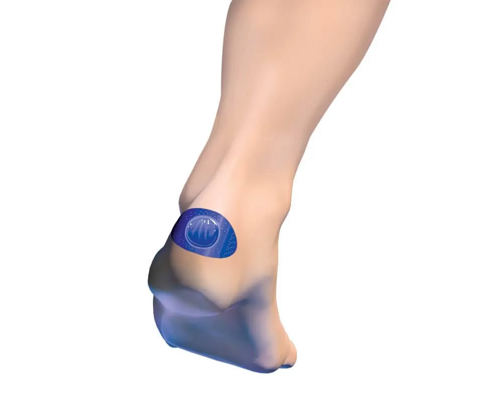 Blist O-band